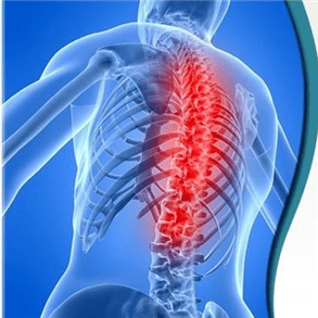 Die Osteochondrose spinaler können durch verschiedene Ursachen verursacht werden