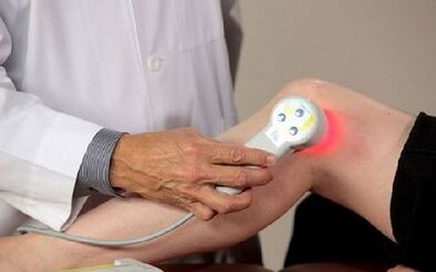 Die Behandlungsmethoden für die Arthrose des Kniegelenks